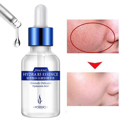 Acido Hialurónico - Hydra B5 Essence REJUVENATE®